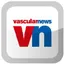 vascularnews